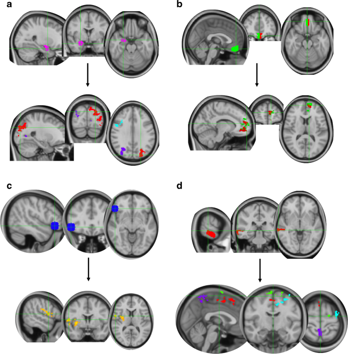 Results of whole brain analyses in the test scan. a The left parietal