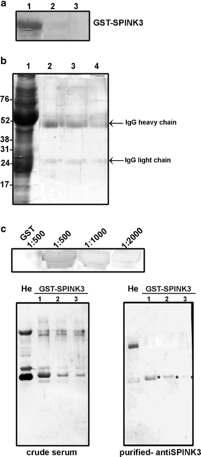 An alternative easy method for antibody purification and analysis of  proteinprotein interaction using GST fusion proteins immobilized onto  glutathioneagarose | Analytical and Bioanalytical Chemistry | Springer  Nature Link