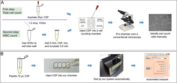 A sample-preparation-free, automated, sample-to-answer system for cell  counting in human body fluids | SpringerLink