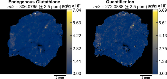 Demonstrating voxel-by-voxel (V  V) single-point calibration in liver  tissue by IR-MALDESI quantitative MSI | Analytical and Bioanalytical  Chemistry | Springer Nature Link