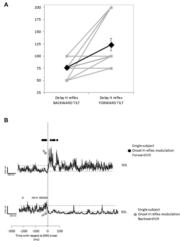 H Reflex Modulation Preceding Changes In Soleus Emg Activity During Balance Perturbation Springerlink