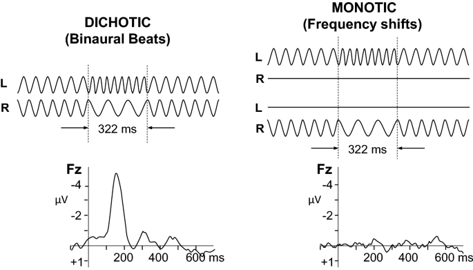 Event-related potentials to single-cycle binaural beats and diotic  amplitude modulation of a tone | SpringerLink