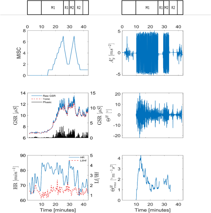 Objective And Subjective Responses To Motion Sickness The Group And The Individual Springerlink