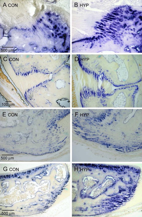 Survey Of The Enthesopathy Of X Linked Hypophosphatemia And Its Characterization In Hyp Mice Springerlink