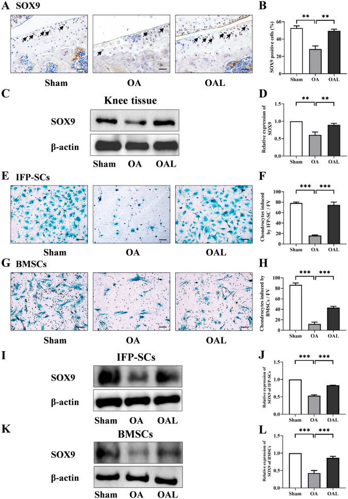 PDF) Excessive mechanical loading promotes osteoarthritis through