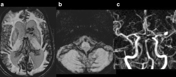 figure 16