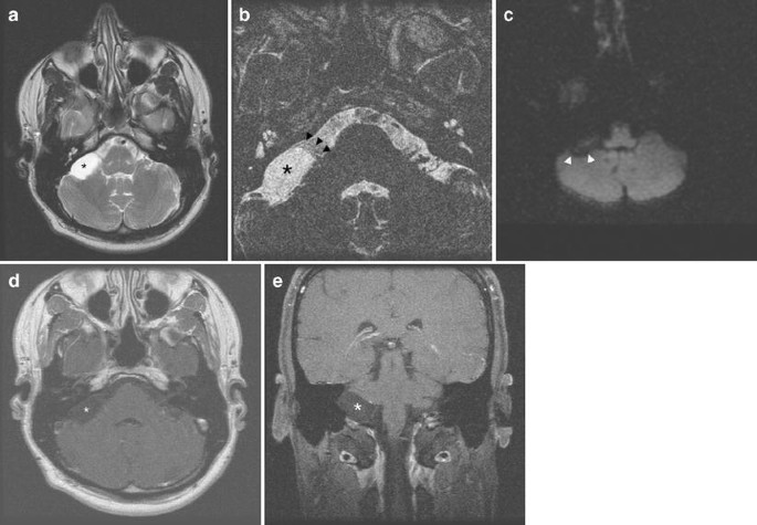 figure 17