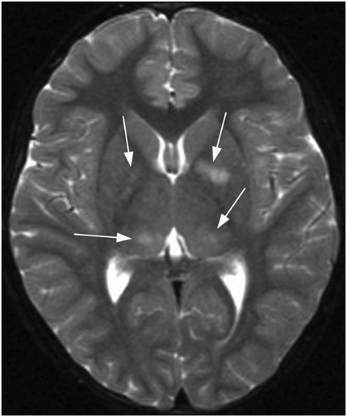 figure 36