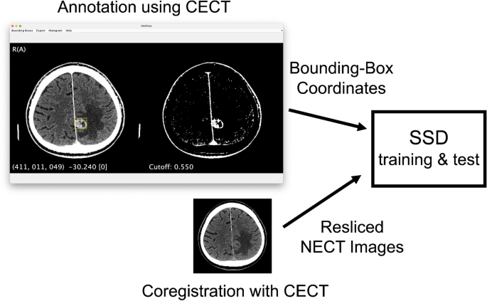 Automated detection of brain metastases on non-enhanced CT using