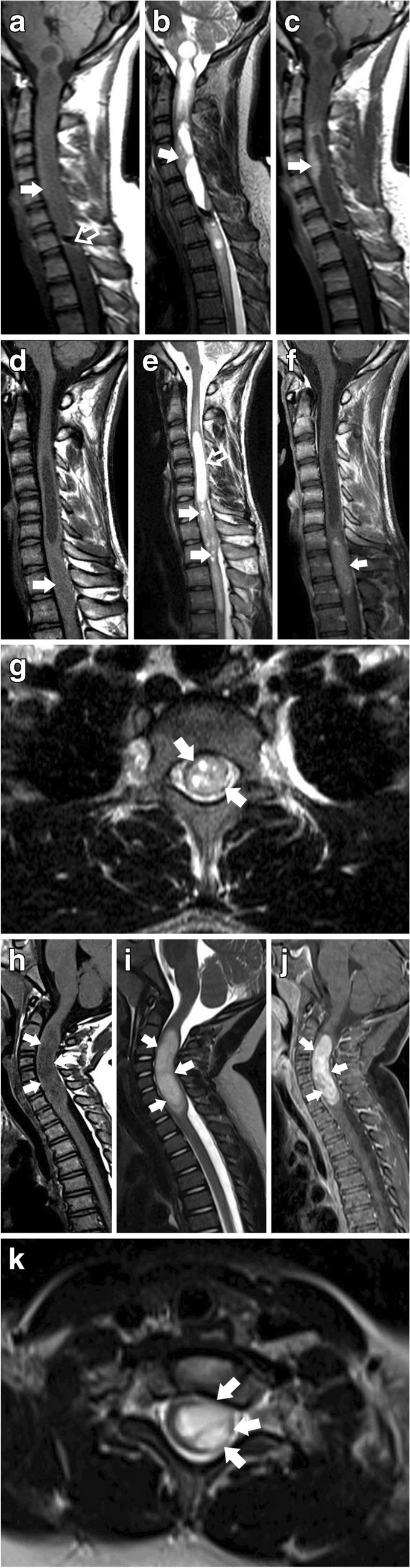 A comprehensive evaluation of imaging features in pediatric spinal ...