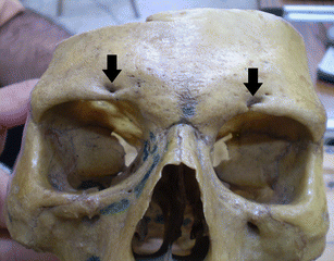 Anatomical variations of supraorbital notch and foramen: a study on human  adult Egyptian skulls | SpringerLink