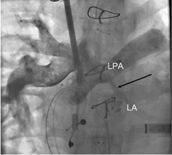 figure 16