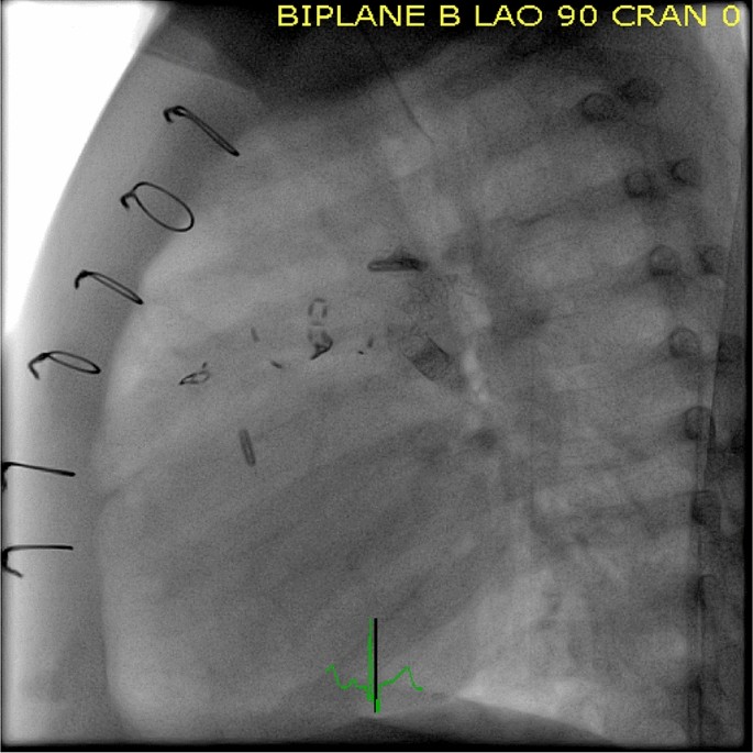 figure 19