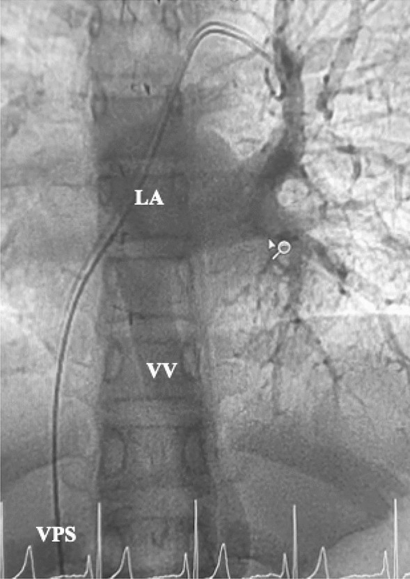 figure 22