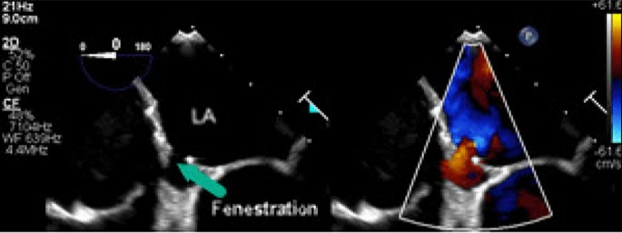 figure 24