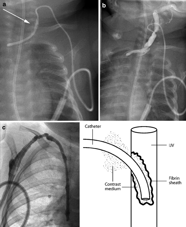 figure 21