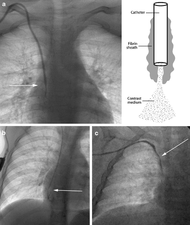 figure 22