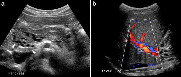 figure 18