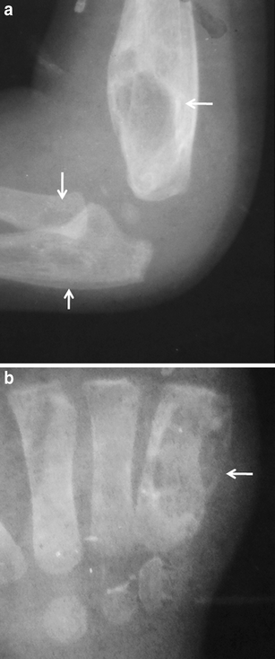 figure 29