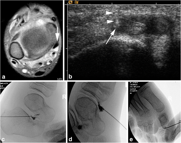 figure 15