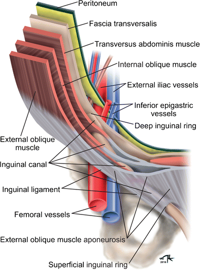 The Challenging Sonographic Inguinal Canal Evaluation In Neonates And Children An Update Of Differential Diagnoses Springerlink
