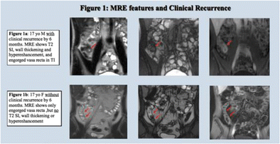SPR 2017 | Pediatric Radiology