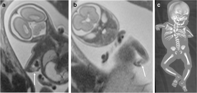 figure 22