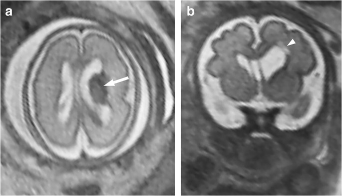 figure 21