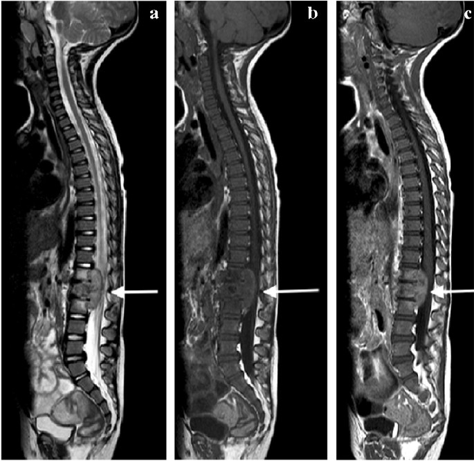 figure 31