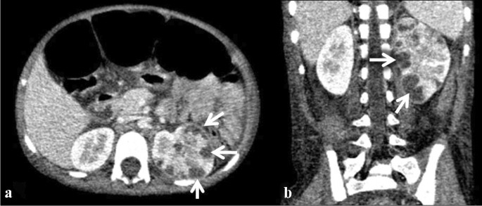 figure 45