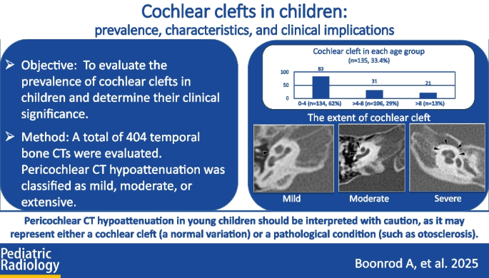Cochlear clefts in children: prevalence, characteristics, and clinical ...