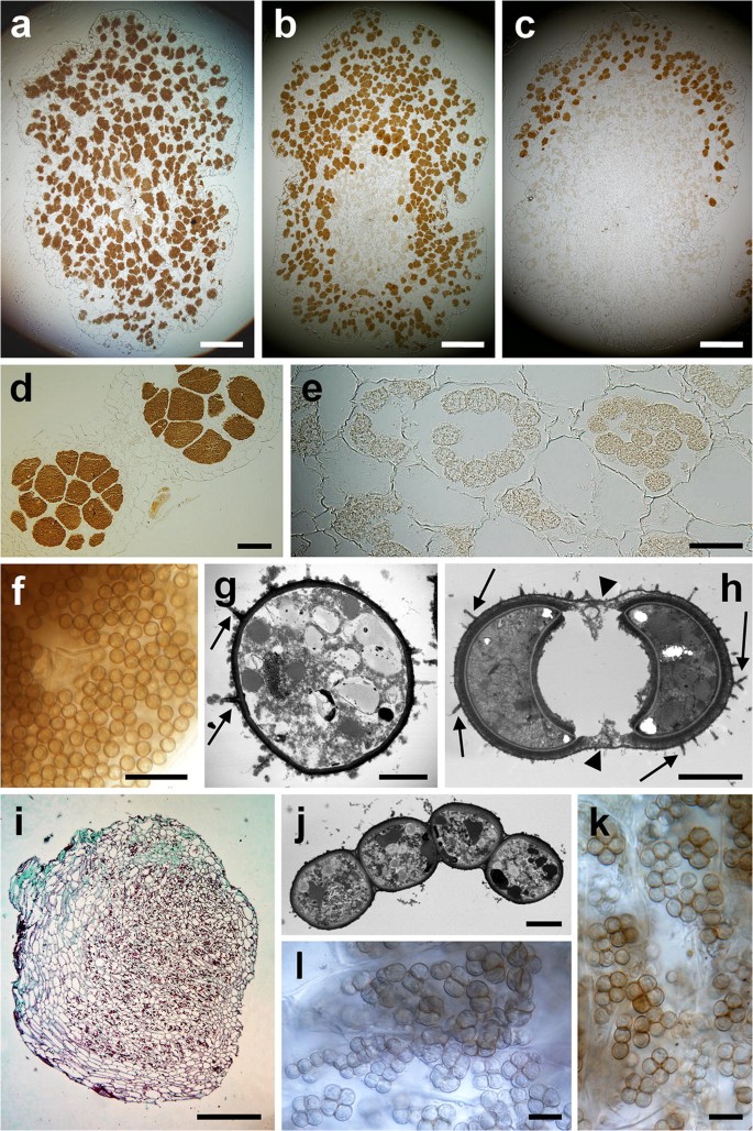 Marinomyxa Gen. Nov. Accommodates Gall-Forming Parasites of the Tropical to  Subtropical Seagrass Genus Halophila and Constitutes a Novel Deep-Branching  Lineage Within Phytomyxea (Rhizaria: Endomyxa) | SpringerLink