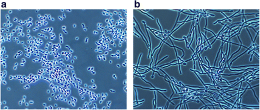 Impacts Of Environmental Conditions On Product Formation And Morphology Of Yarrowia Lipolytica Springerlink