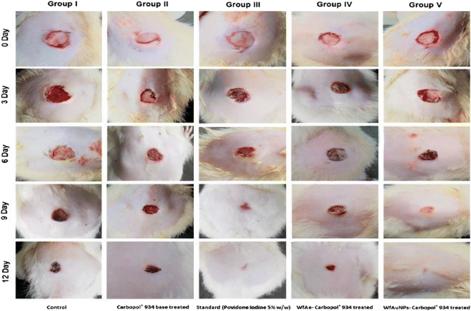 colloidal silver dressing Silver Wound Dressings Explained