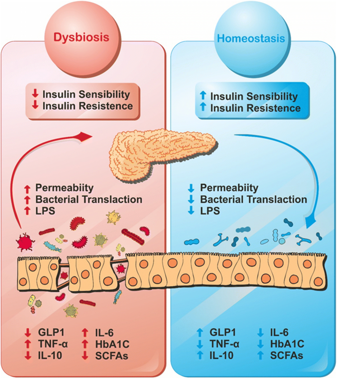 Relationship between gut microbiota, probiotics, and type 2 diabetes  mellitus | SpringerLink