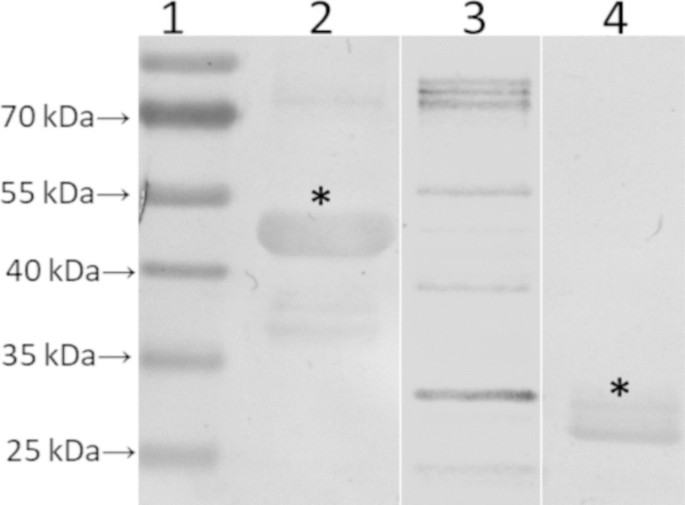 Chimeric lipoproteins for leptospirosis vaccine: immunogenicity and protective potential | Applied Microbiology and Biotechnology chimeric-lipoproteins-for-leptospirosis-vaccine-immunogenicity-and-protective-potential-applied-microbiology-and-biotechnology