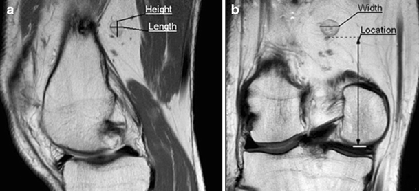 Features of the popliteal lymph nodes seen on ...