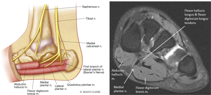 Mri Appearance Of Jogger S Foot Springerlink