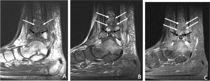 figure 19