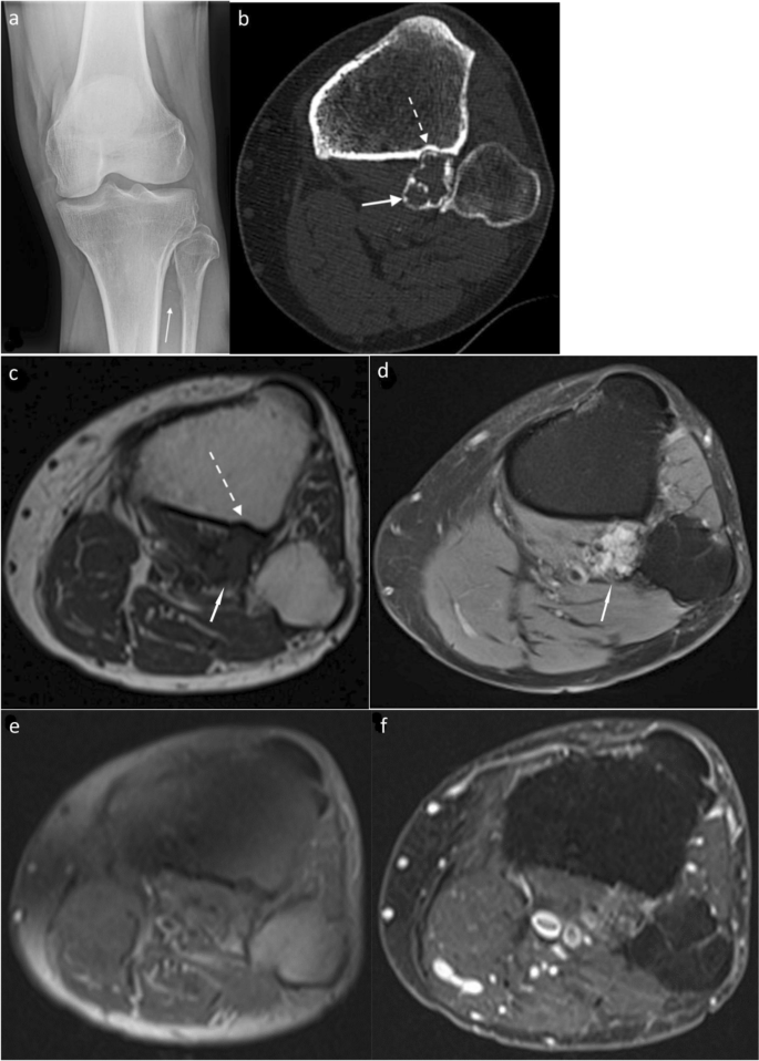 figure 19