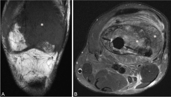 Test yourself answer: A 49-year-old male presents with left leg pain ...