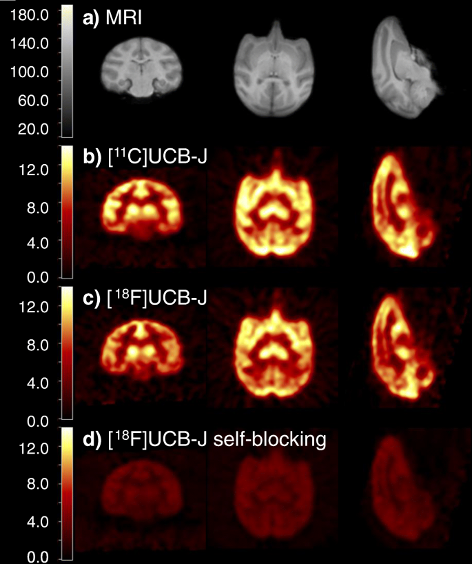 Synthesis And In Vivo Evaluation Of 18 F Ucb J For Pet Imaging Of Synaptic Vesicle Glycoprotein 2a Sv2a Springerlink