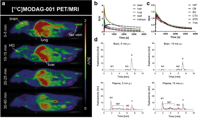 11 C]MODAG-001—towards a PET tracer targeting  -synuclein ...