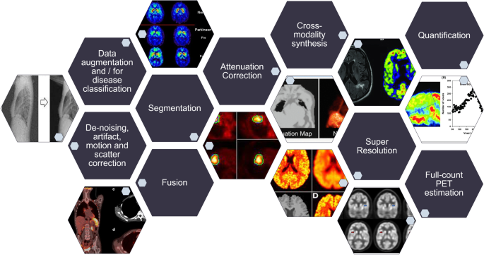 Conditional Generative Adversarial Networks Aided Motion Correction of  Dynamic 18F-FDG PET Brain Studies