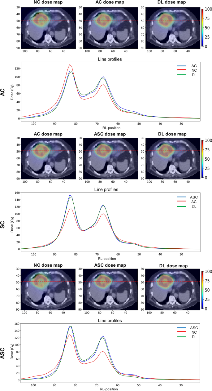 CT-free attenuation and Monte-Carlo based scatter correction-guided ...