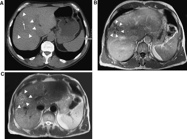 figure 17