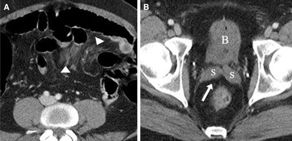 figure 16