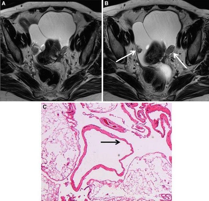 figure 19