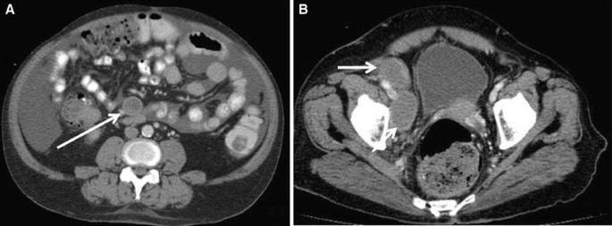 figure 25