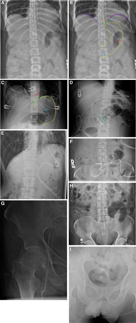 figure 34